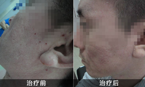 治疗湿疹最好的医院在哪_地址_电话,重庆皮肤科医院